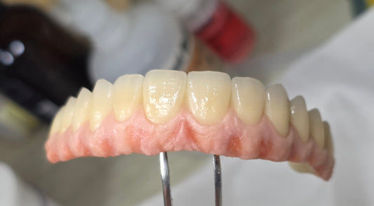 Como evitar retração na cerâmica dental